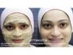 Permanent Skin Lightening Skin Whitening Products +27738432716